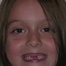 image dents-entrain-pousser