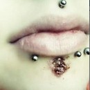 image piercing-infection